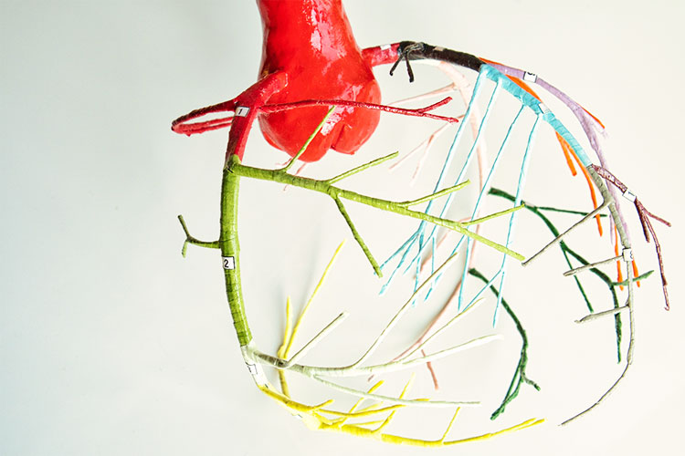 冠動脈イメージ