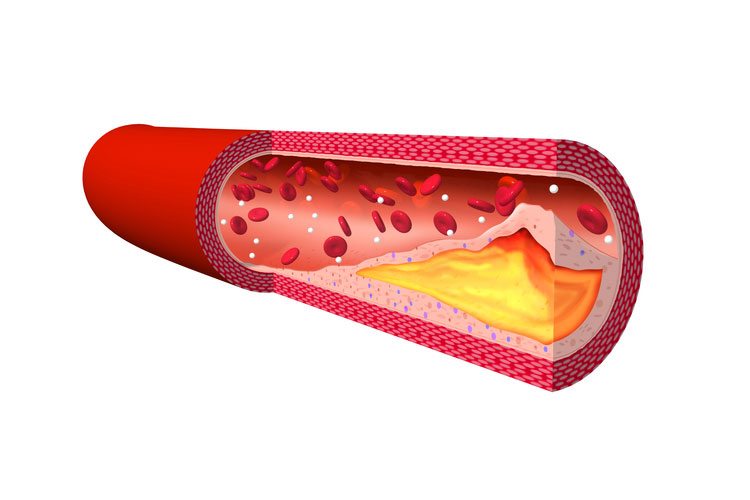 原因と危険因子イメージ
